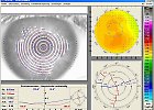 Für Ihre Augen nur das Beste - Schwanke Optik - Kontaktlinsen vom Profi